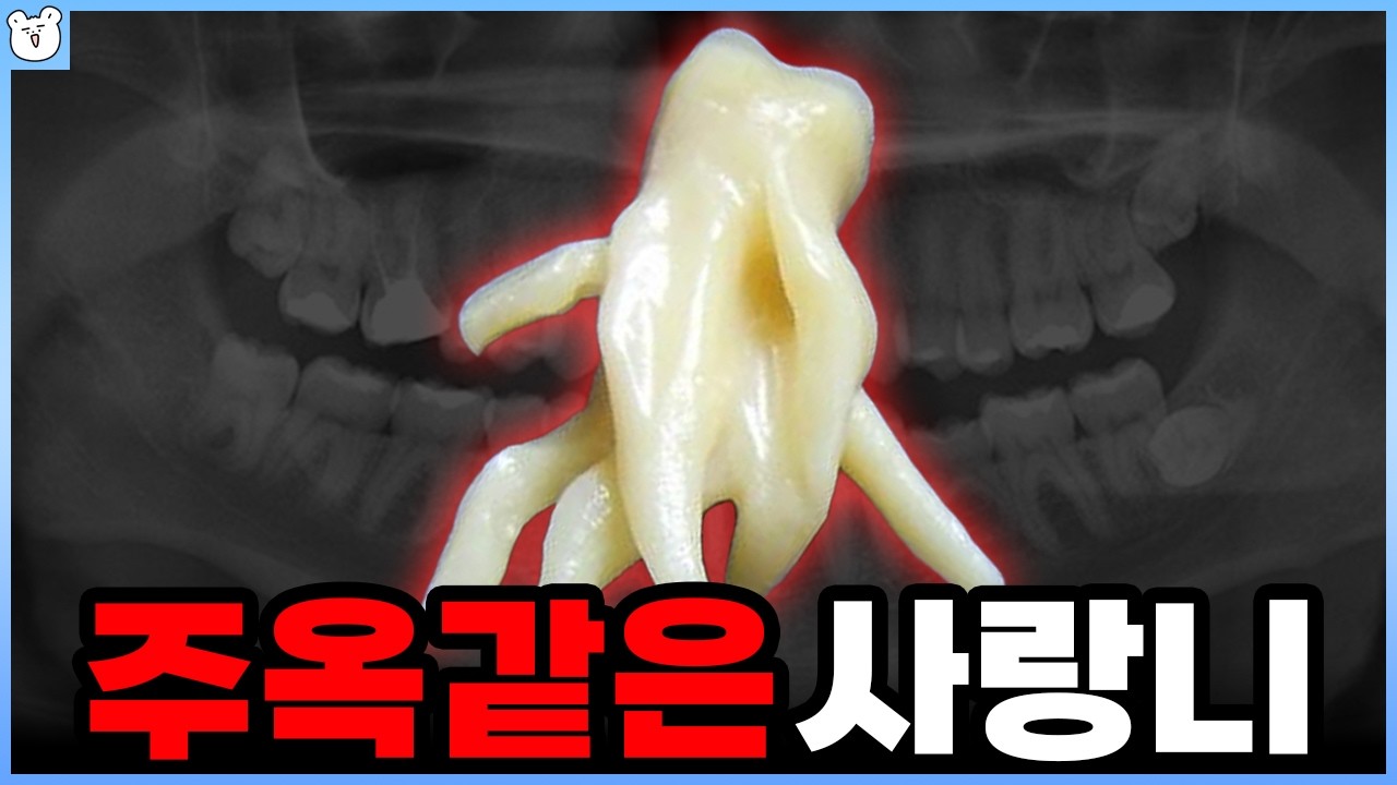 왜 얘는 맨날 매복하고 있는 걸까? ｜요즘은 사랑니를 이렇게 써먹는다