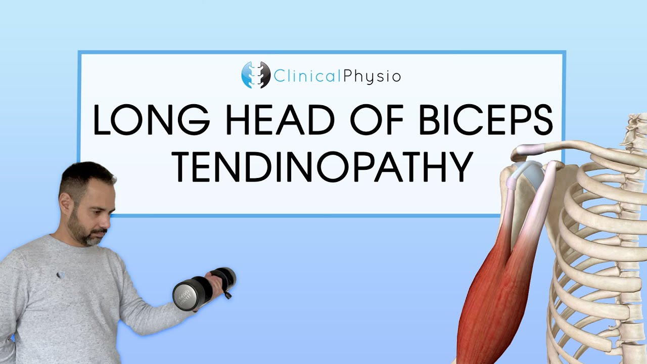 Long Head Biceps Tendinopathy | Expert Physio Review
