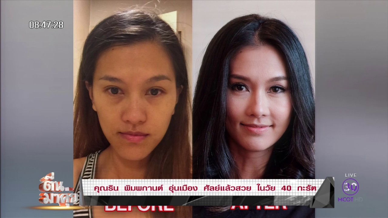 “DA Consultation”ดร. ลี ซัง วู ศัลยแพทย์ชื่อดังผู้เชียวชาญด้านโครงหน้า