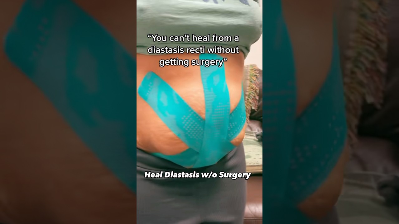 Heal Diastasis w/o Surgery! #diastasis #core #mom #doctor #pregnancy #fyp #health #viralvideo #core