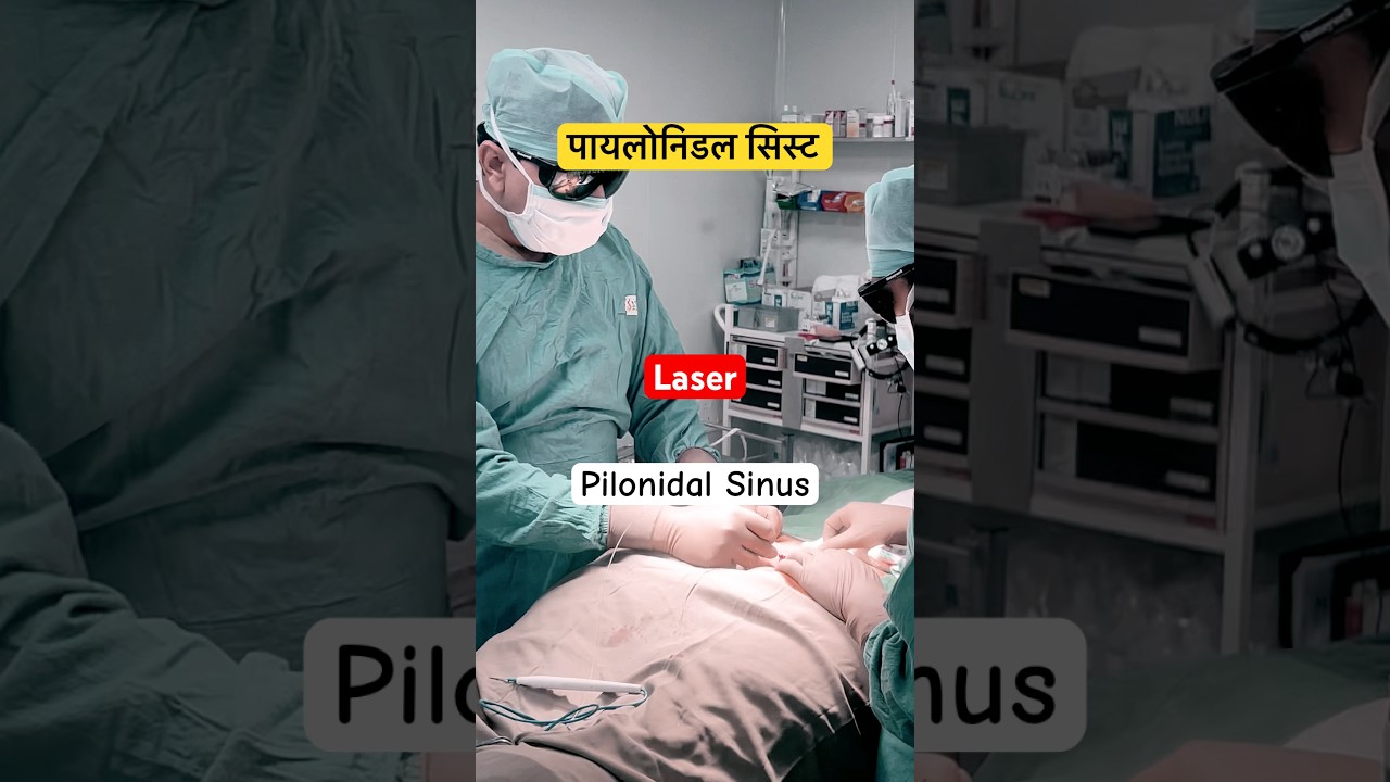 Pilonidal Cyst Laser Treatment In Nashik #shortsfeed #shorts #viral #pilonidal