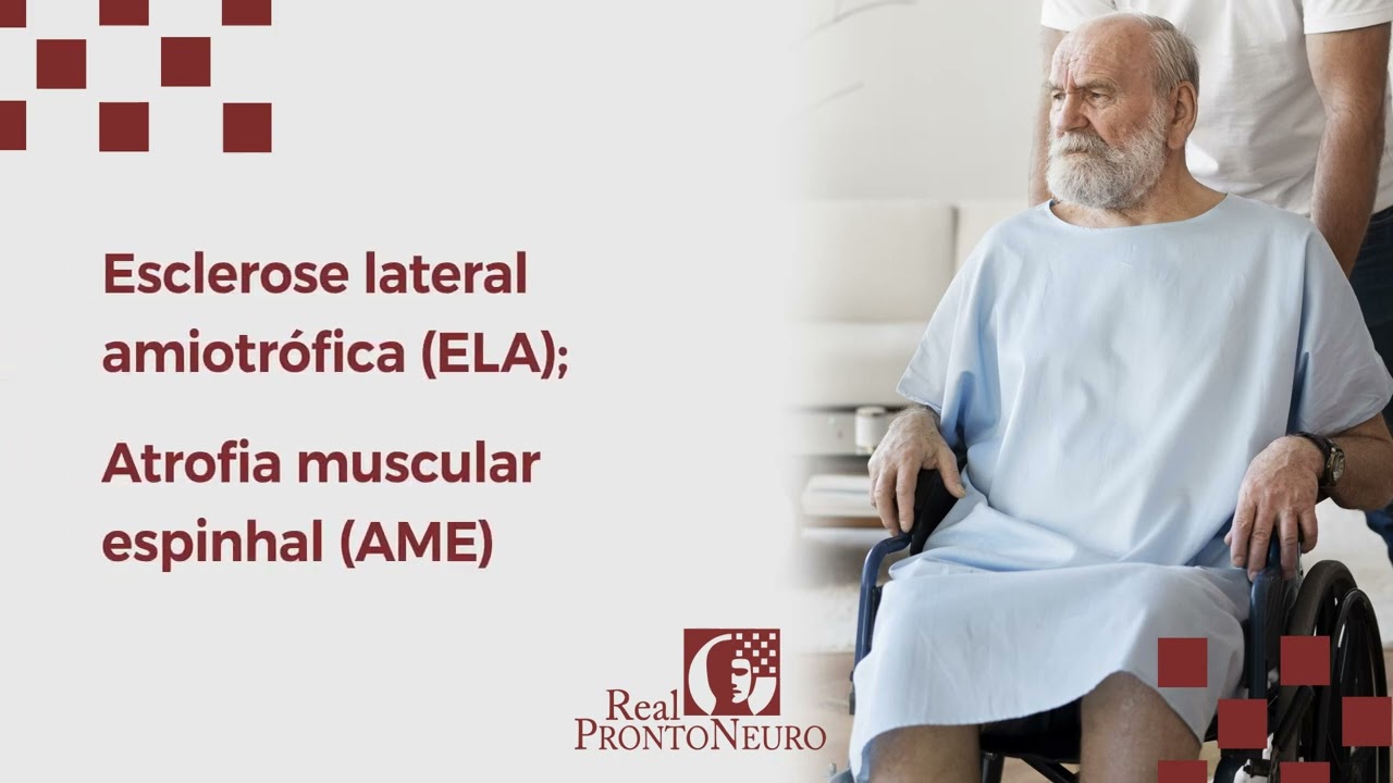 Principais doen&ccedil;as neurol&oacute;gicas degenerativas