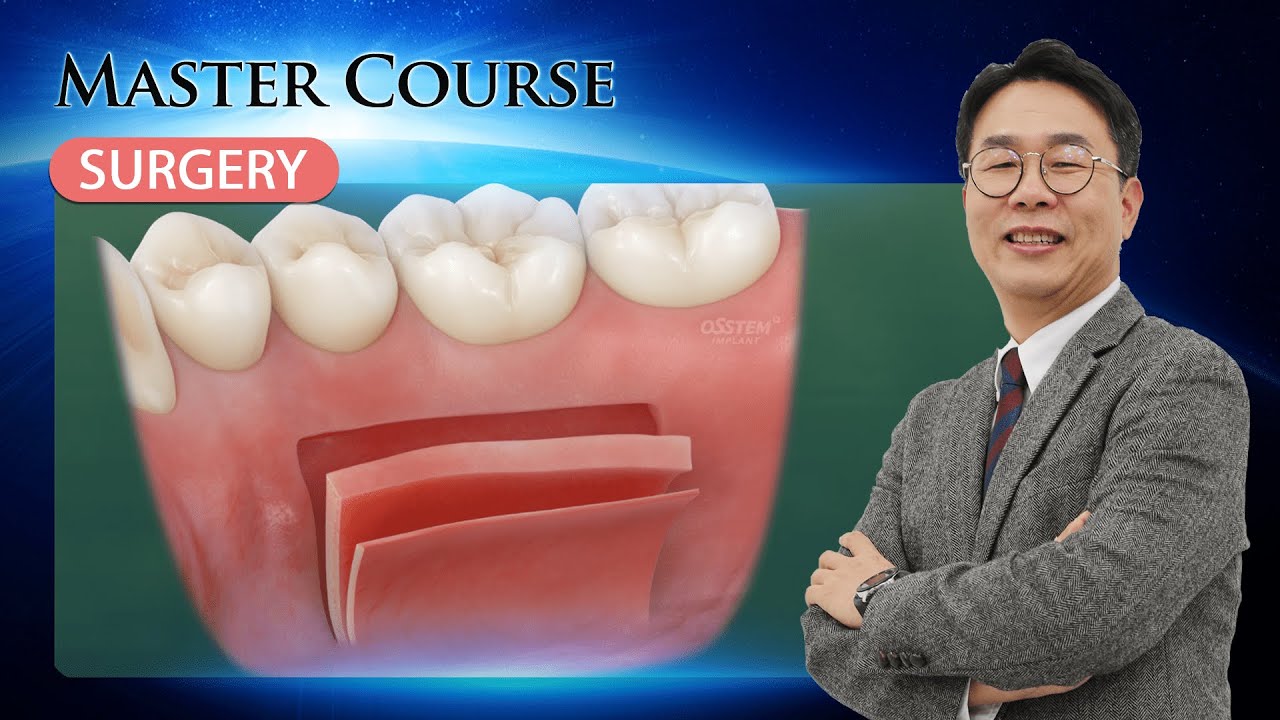 [Master Course - SURGERY] How to Successfully Master FGG and CTG Procedures