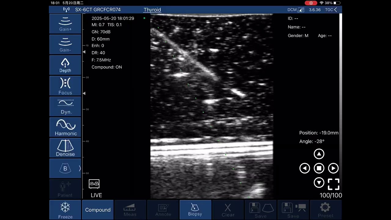 TodoPocus&trade; D3-Ultra In-plane & Out-of-plane Needle Tracking System Demo