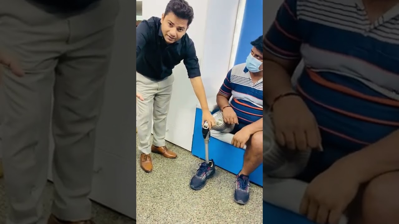 Nakli taang above knee leg सिलिकॉन लाइनर और लॉक के साथ घुटने के कृत्रिम अंग