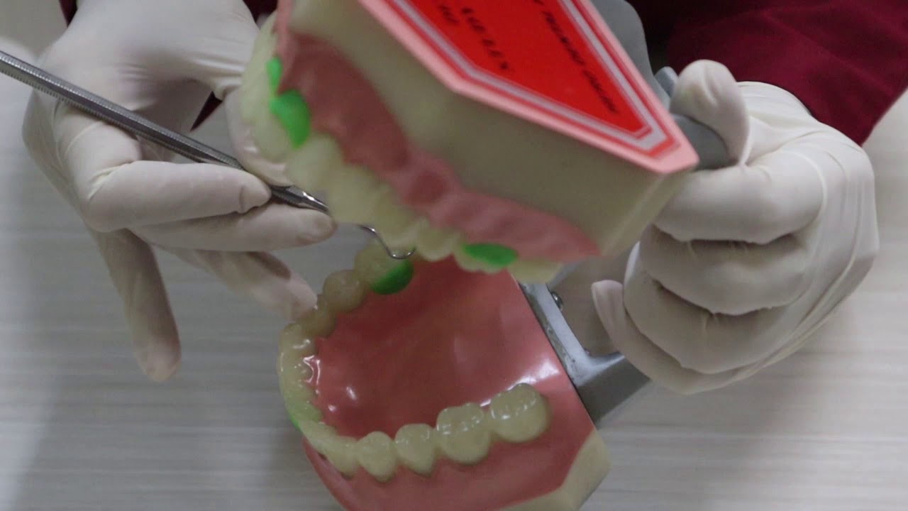 Indeks dan Metode Penilaian Oral Hygiene Status