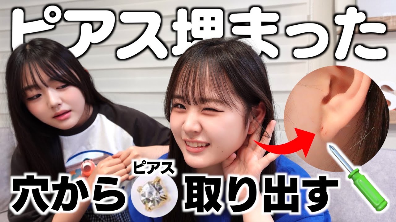 ピアスの飾り部分がピアスの穴から耳たぶの中に入った‥自力で取り除く？病院だったら何科へ行くん？