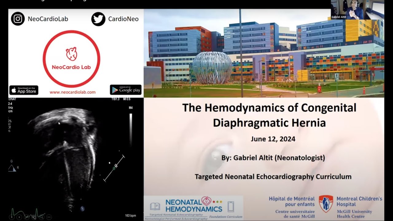 Hemodynamics of Congenital Diaphragmatic Hernia