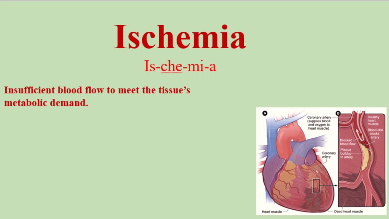 Ischemia Pronunciation and Definition - How to pronounce Ischemia