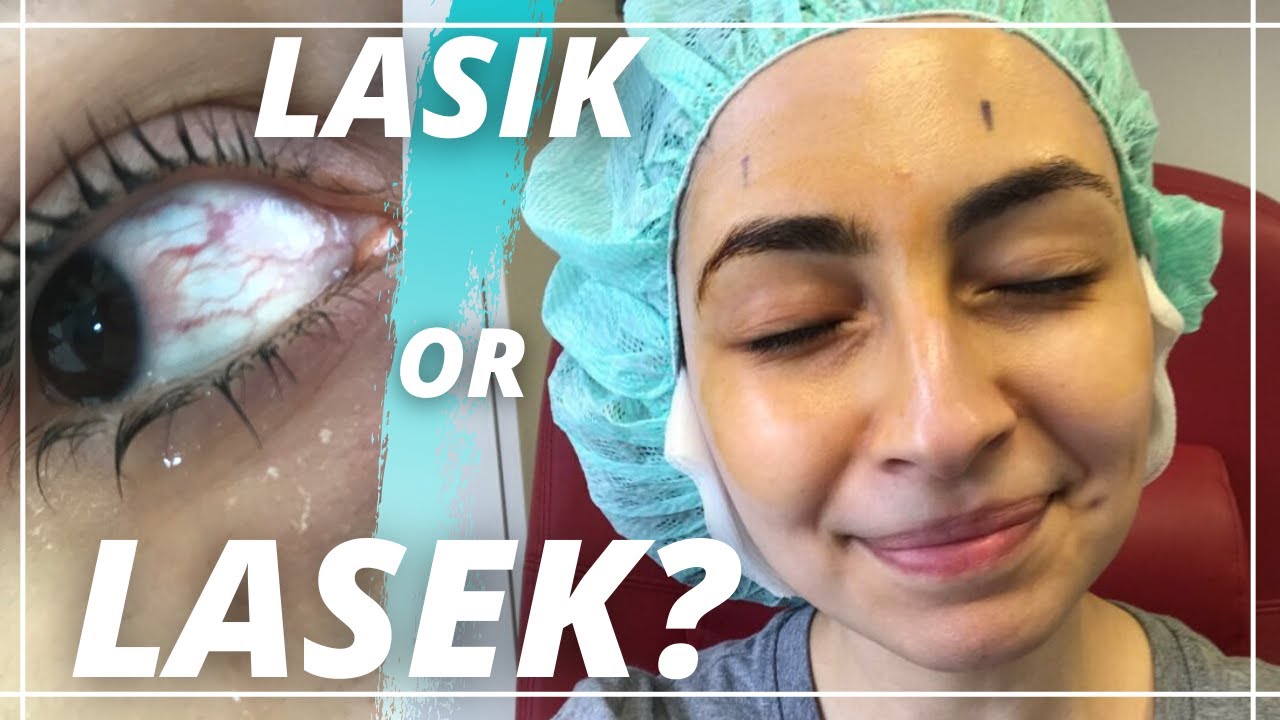 LASEK vs LASIK difference?? My Laser Eye Surgery Experience Day 1 - 2 year UPDATE VLOG!