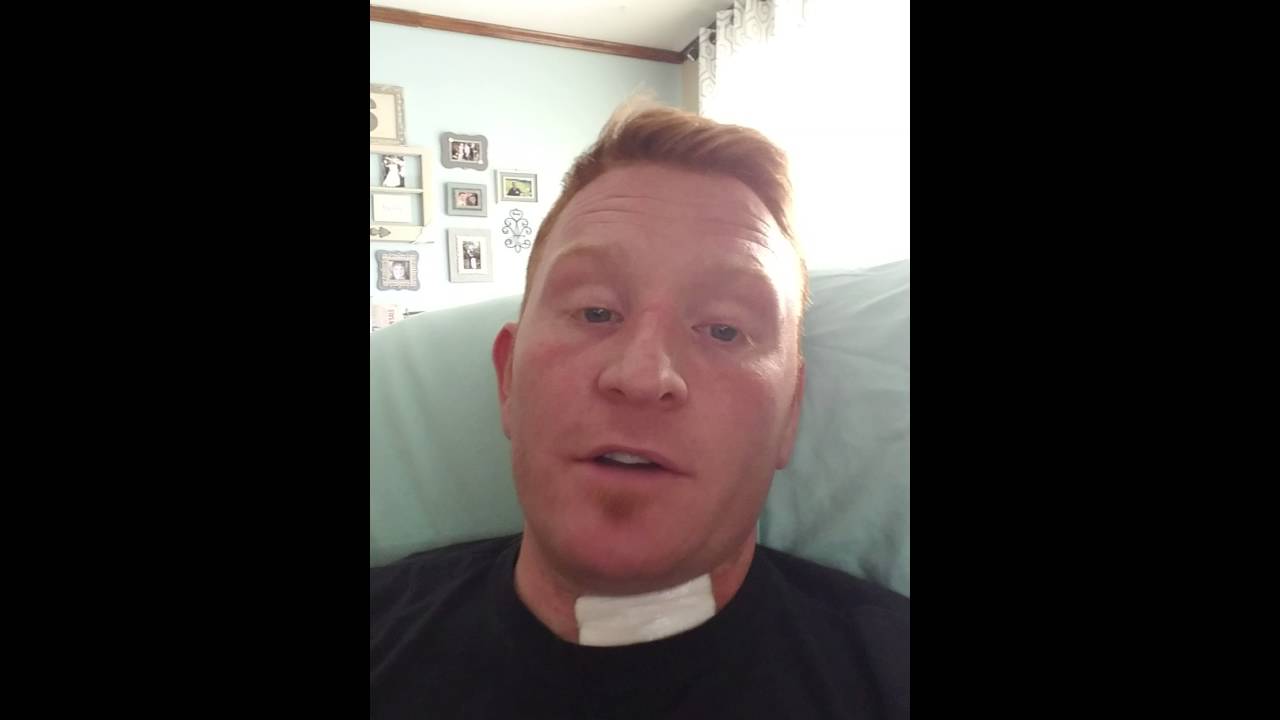 ACDF Surgery C6-C7 DAY 3 Post Op 5/20/16