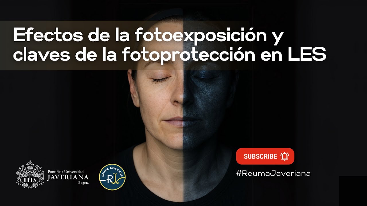 Efectos de la fotoexposición y claves de la fotoprotección en LES