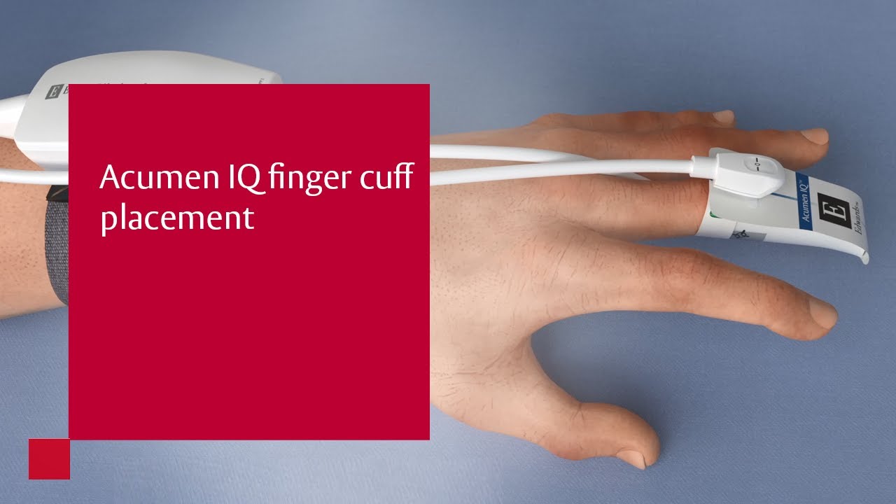 Acumen IQ finger cuff placement