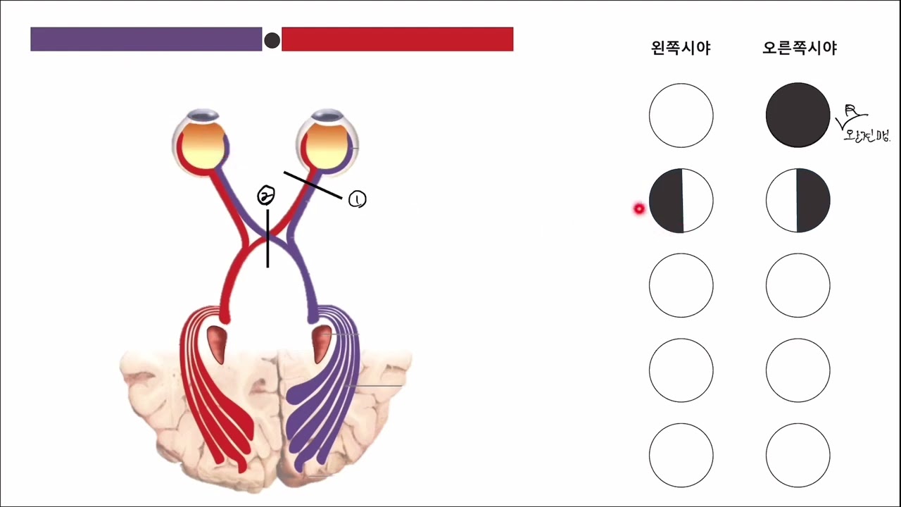 [JeNa's 안과학 특강] 
