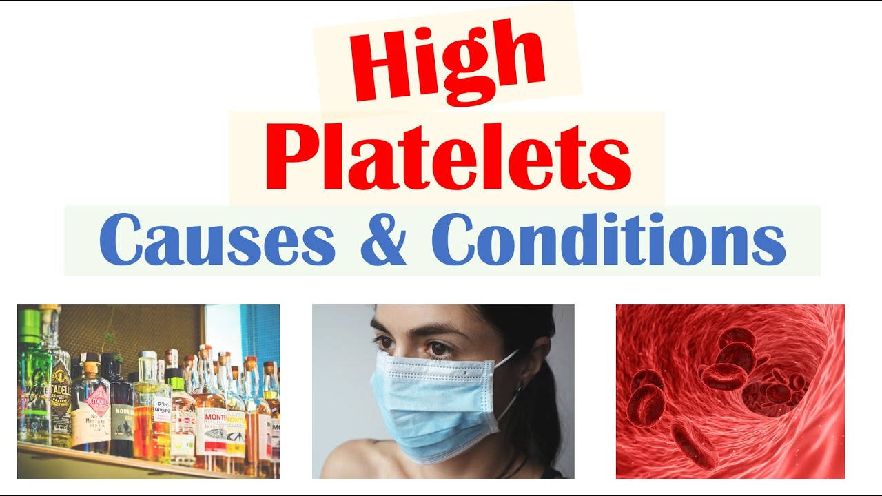 Causes of High Platelets (Thrombocytosis) | Rapid Review
