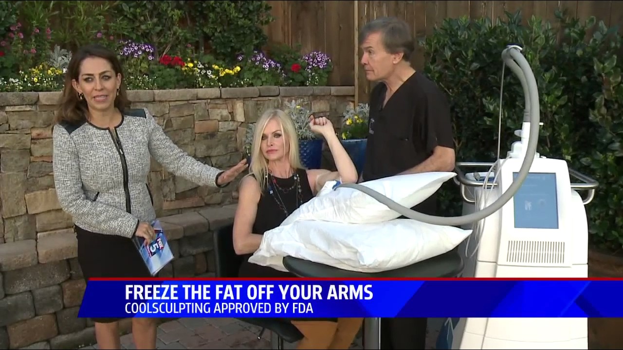 Fox5 - CoolSculpting for Arms - February 21, 2017