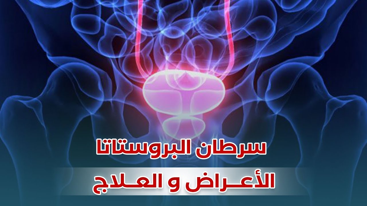 ماهي أعراض سرطان البروستا وكيف نعالجه ؟