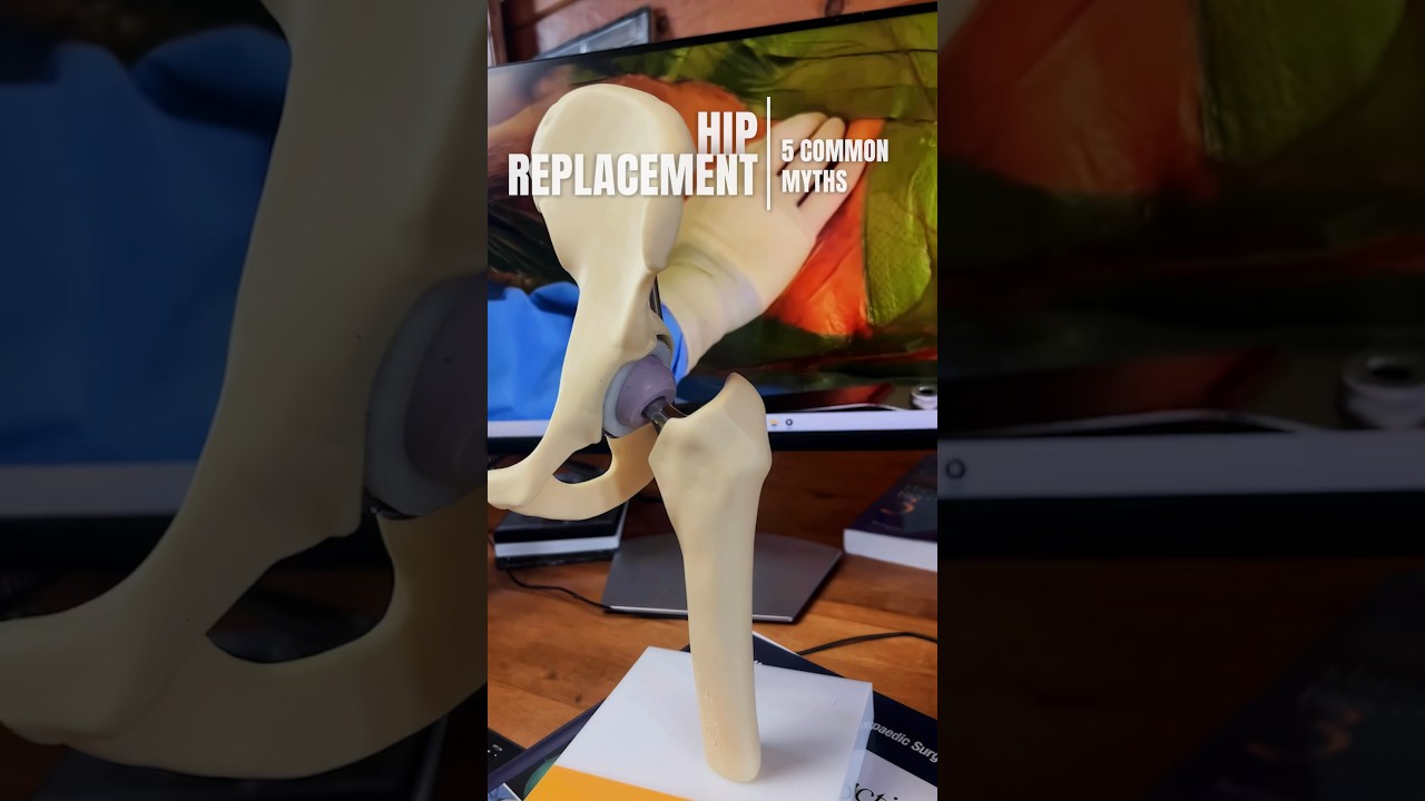 Top Lies About Hip Replacement Surgery 👇 #shorts