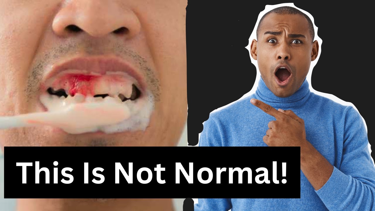 Bleeding Gums: Should You Worry? Causes, Treatments & Prevention
