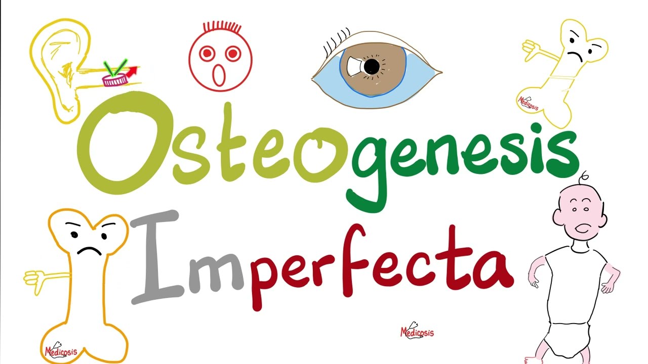 Osteogenesis Imperfecta (OI) - Brittle Bone Disease - Causes, Symptoms, Diagnosis, Treatment