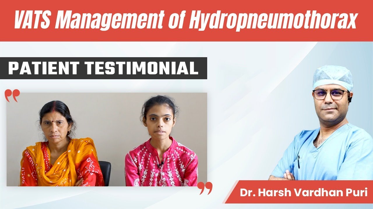 VATS management of Hydropneumothorax | Patient Testimonial | When to refer for Thoracic Surgery?
