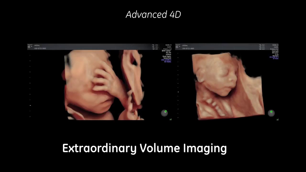 VOLUSON E8 GE| SIYS MEDICAL