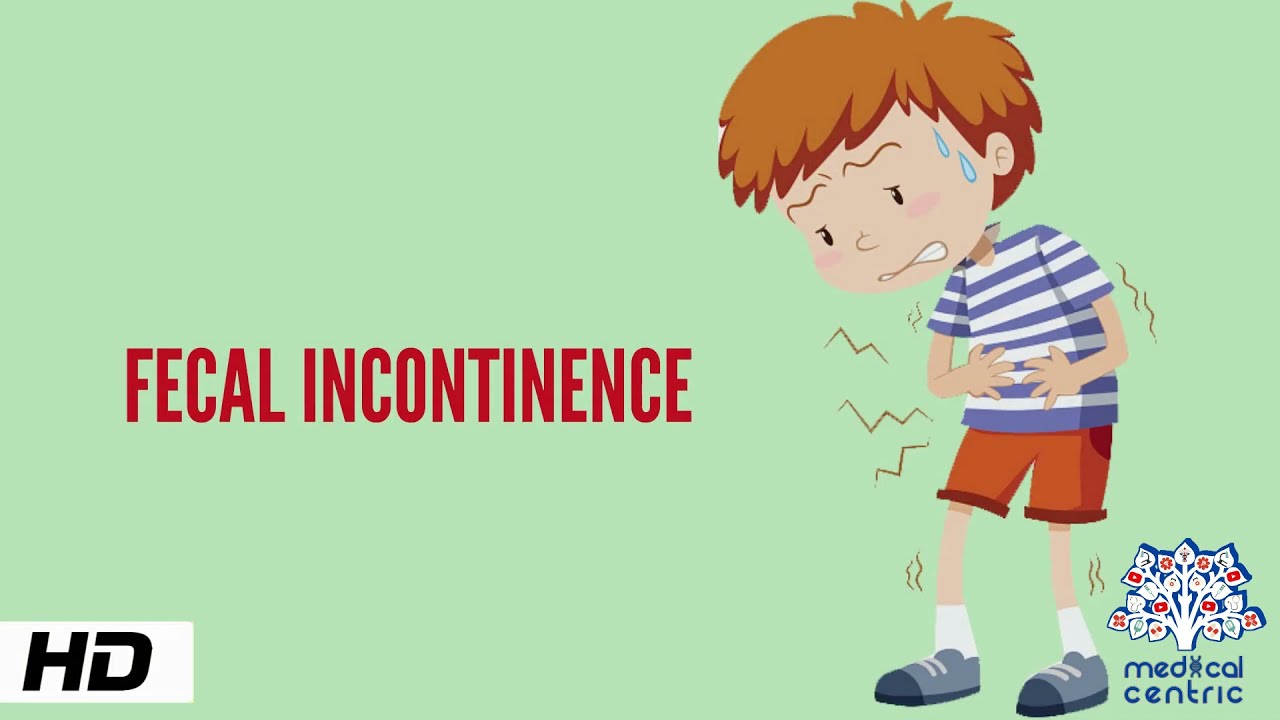 Fecal Incontinence, Causes, Signs and Symptoms, Diagnosis and Treatment.