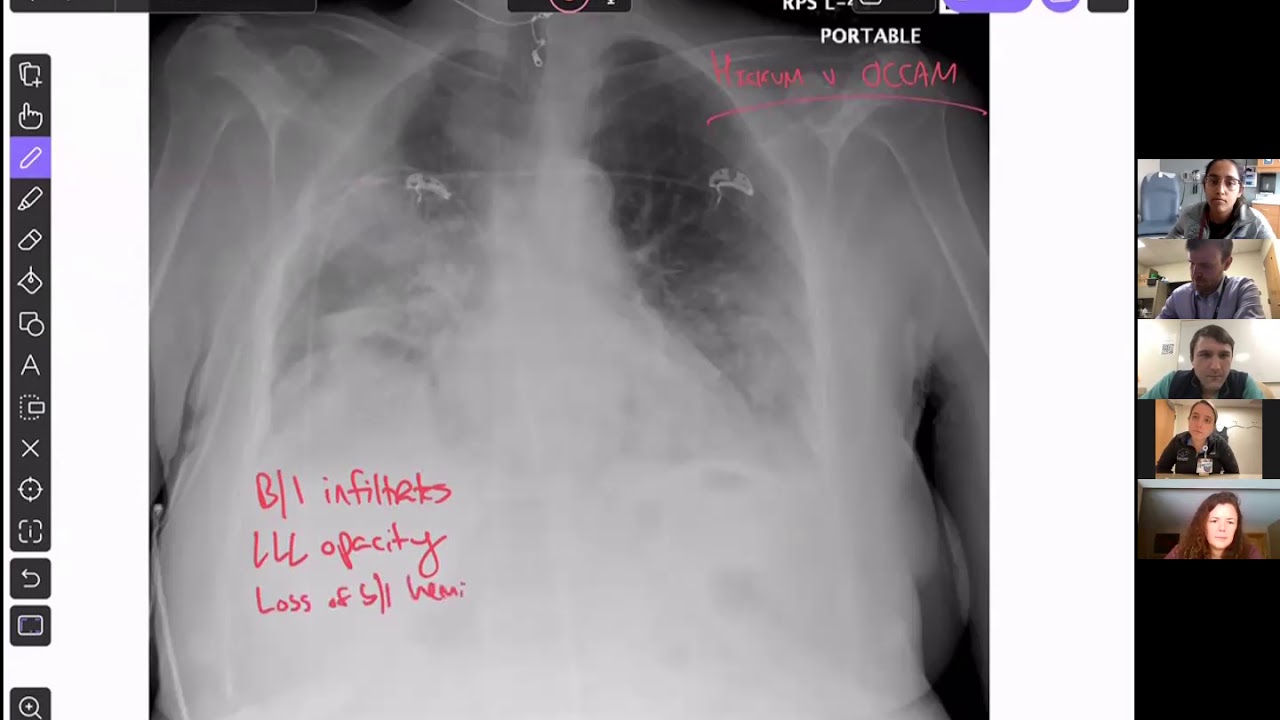 Cold Case: A Curious Case of Co-Infection