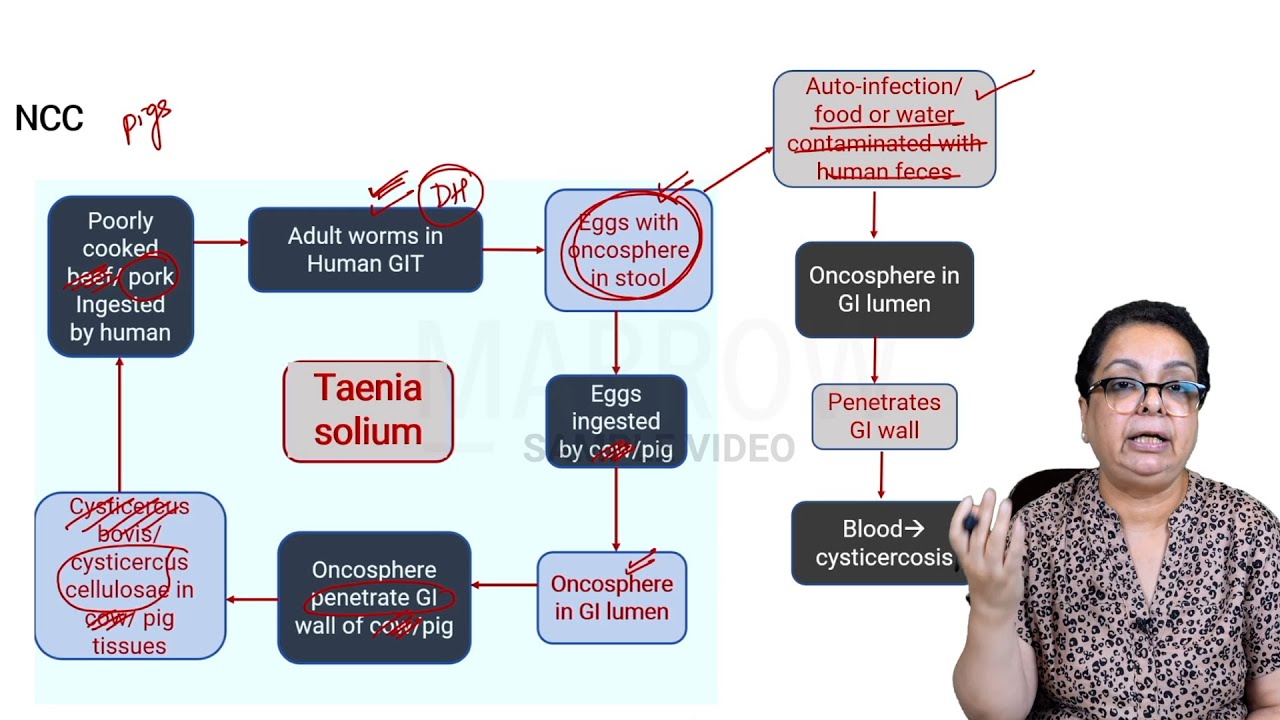 E6 Sample Video: Toxoplasmosis and Neurocysticercosis (Microbiology)