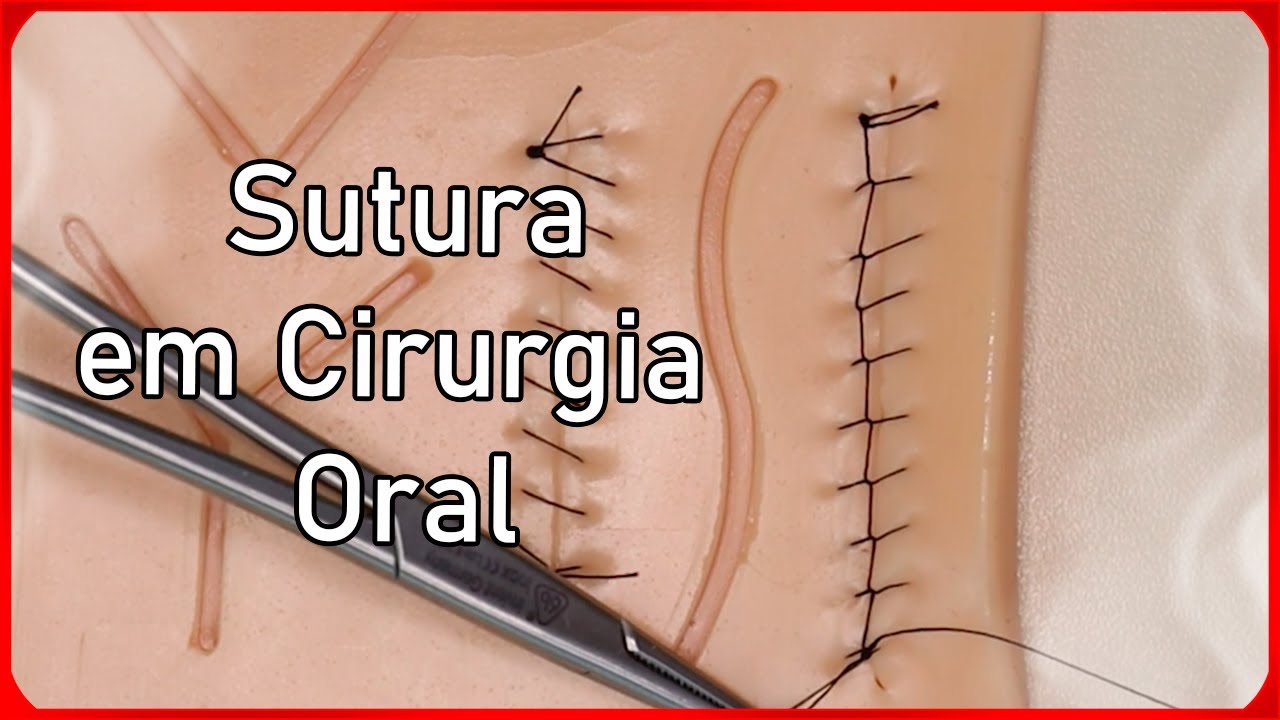 Técnicas de Sutura em Cirurgia Oral Menor