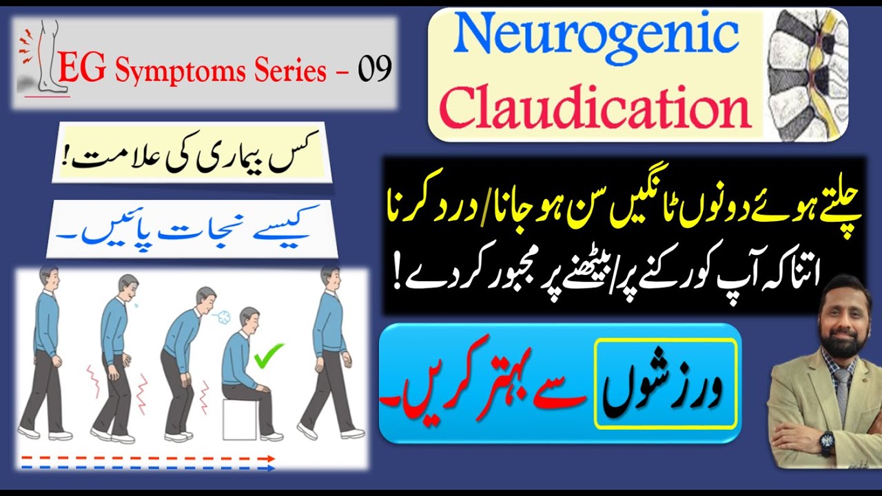 Neurogenic Claudication: اعصابی لنگڑاہٹ  : Urdu/Hindi |Dr. Ali Hassan