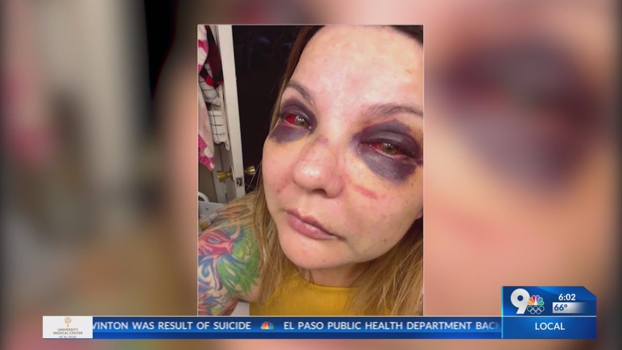 Attorney of woman who claimed she was beaten by EPPD calls for her DWI to be dropped