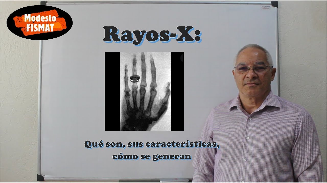 Rayos X: Qué son, sus características, cómo se generan