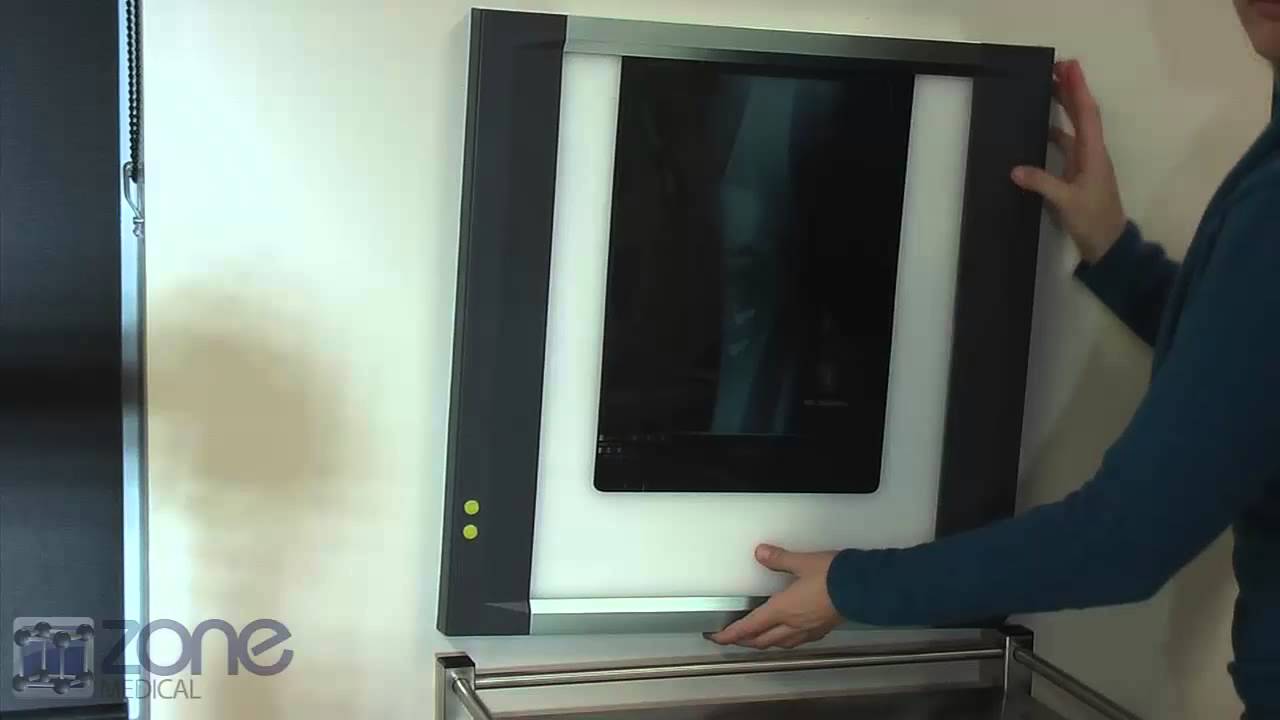 Minston Xray Viewer