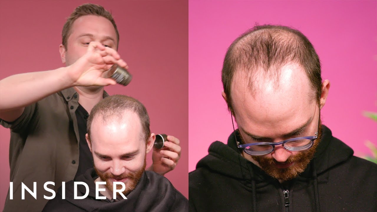 The Concealer For Thinning Hair | It’s Cool, But Does It Really Work?