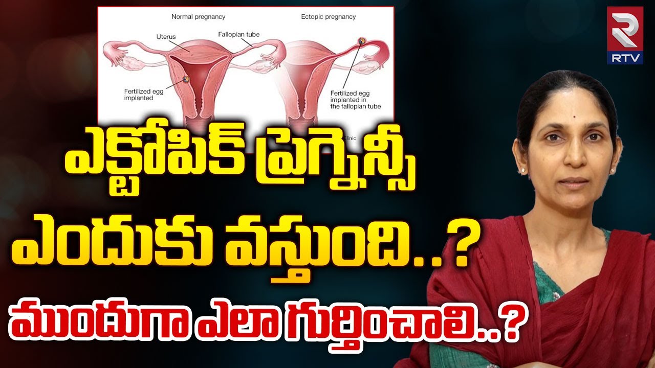 What are the Signs of Ectopic Pregnancy | Ectopic pregnancy Treatment In Telugu | RTV