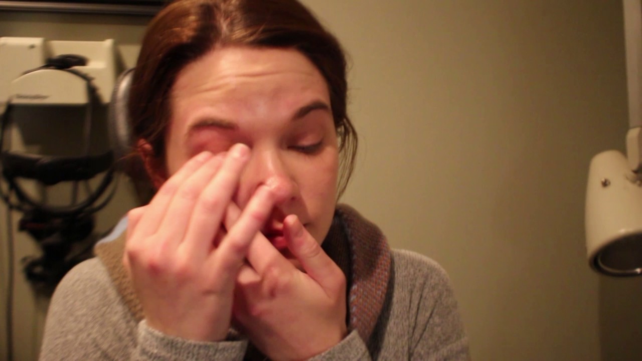 Blephadex Eyelid Foam