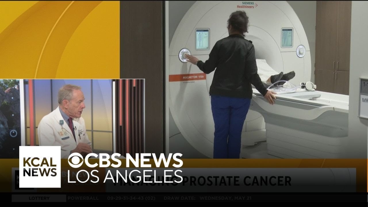 A doctor discusses prostate cancer, testing, survival and Biden’s diagnosis