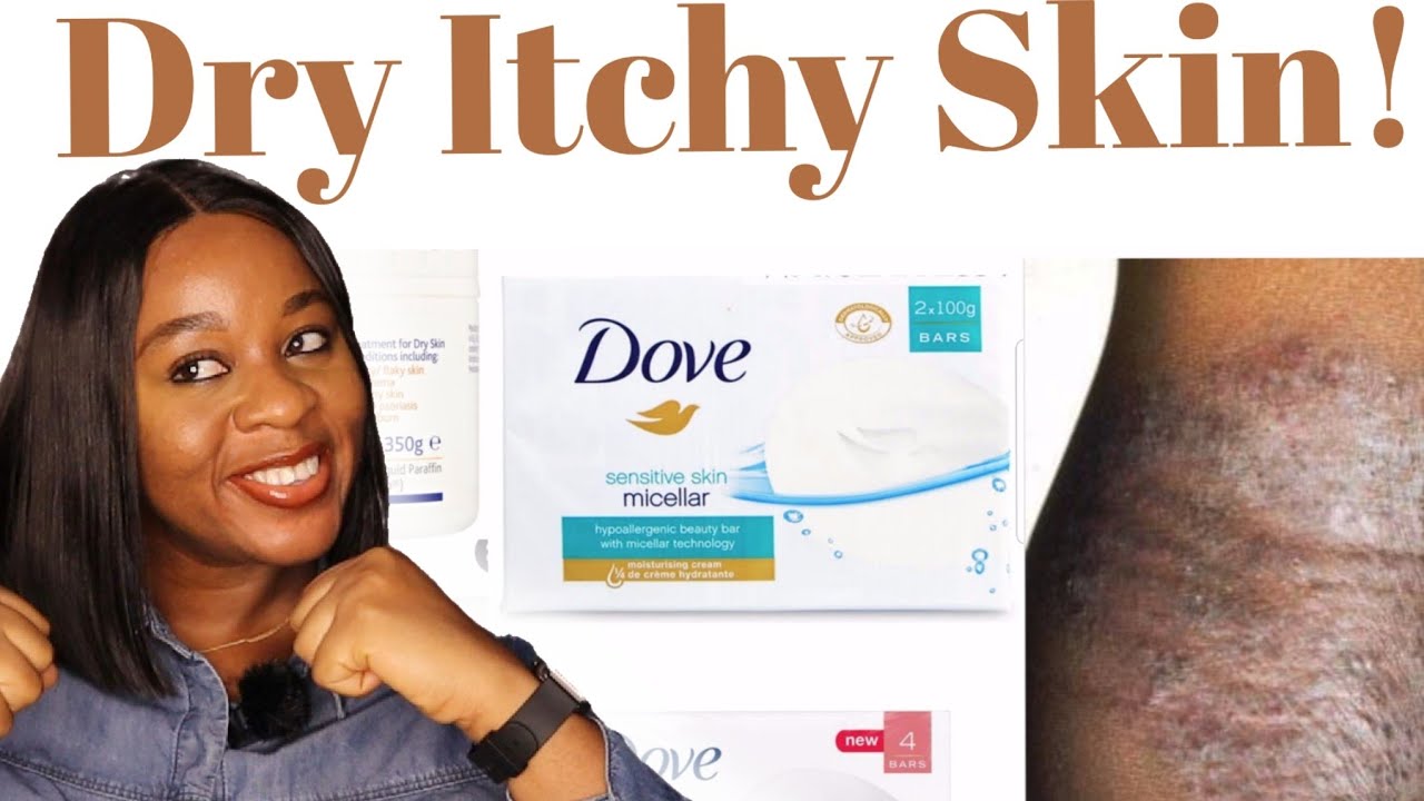 Get Rid of Skin Rashes caused by Dry, Flaky, Itchy Skin using Two Products.