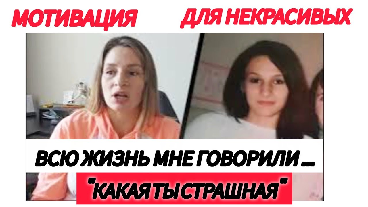 Детство в Слезах. Мечты об операции. Какая я была в 14 лет, страшная...Мотивация для женщин