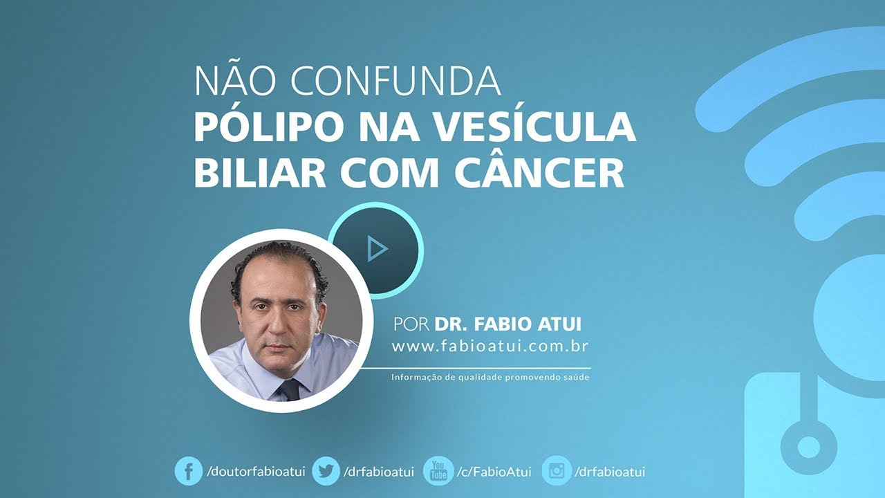 Pólipo na vesícula - Por Dr  Fabio Atui 16/08/2017
