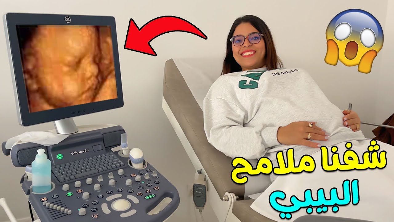 أخيرا شفنا ملامح البيبي الجديد❤ يونس تصدم😱شوفوا لمن كيشبه ‼