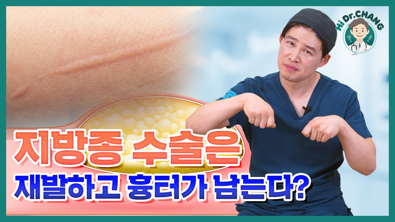 지방종 수술하면 재발하고 흉터 남는다? 진실 공개!