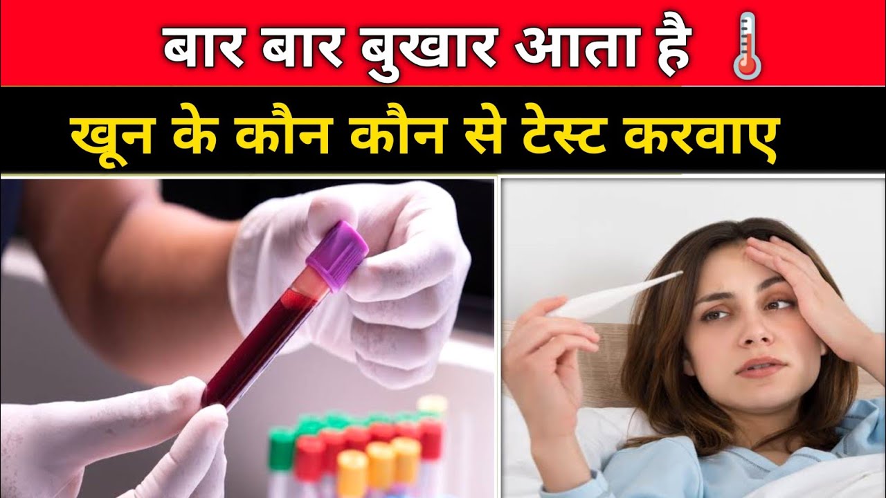 बार बार बुखार आने पर कौन सा Blood Test करे 🩸| fever treatment | Bukhar aane par kaun sa test kare 😲