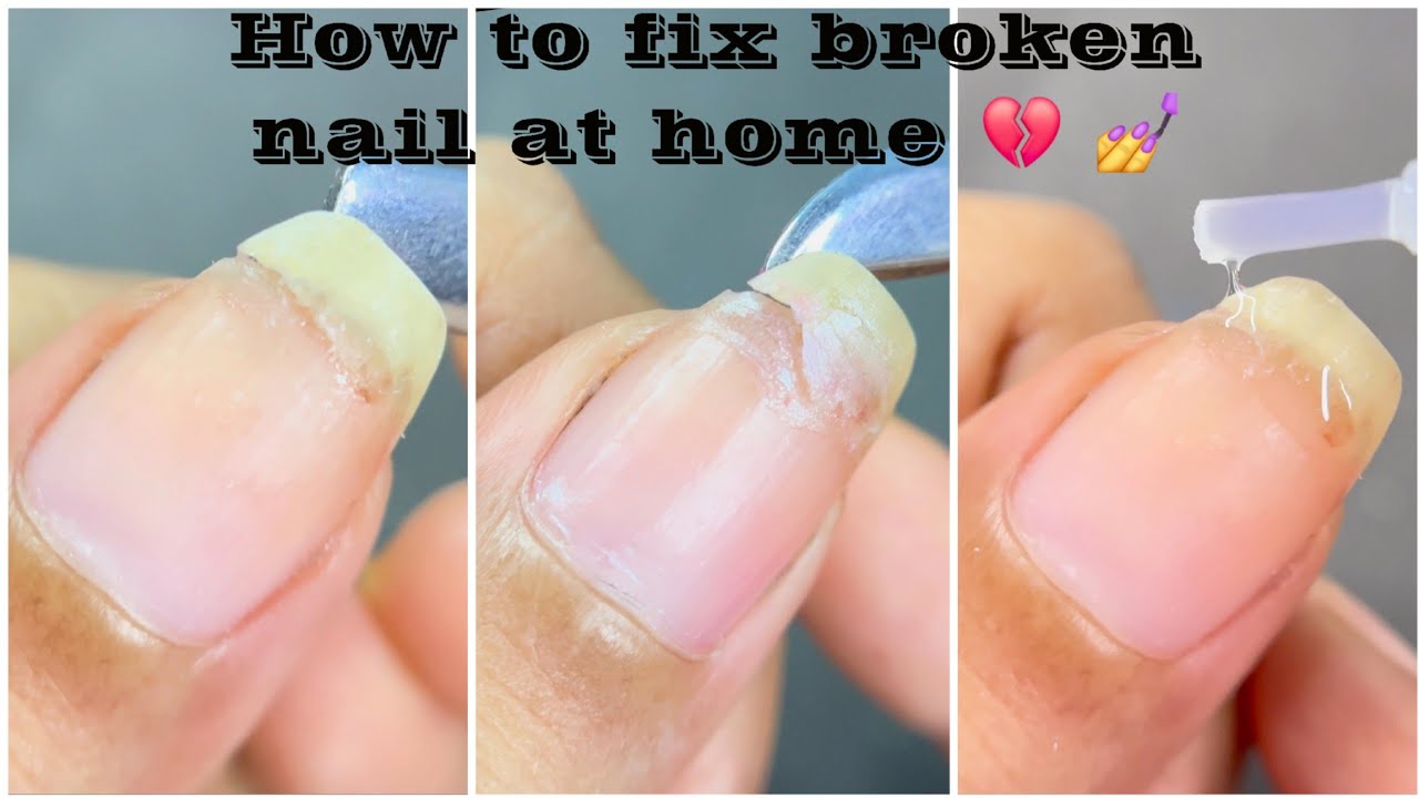 💔How to fix broken nail at home | Nail repair hacks Without a tea bag|How to quickly fix broken nail