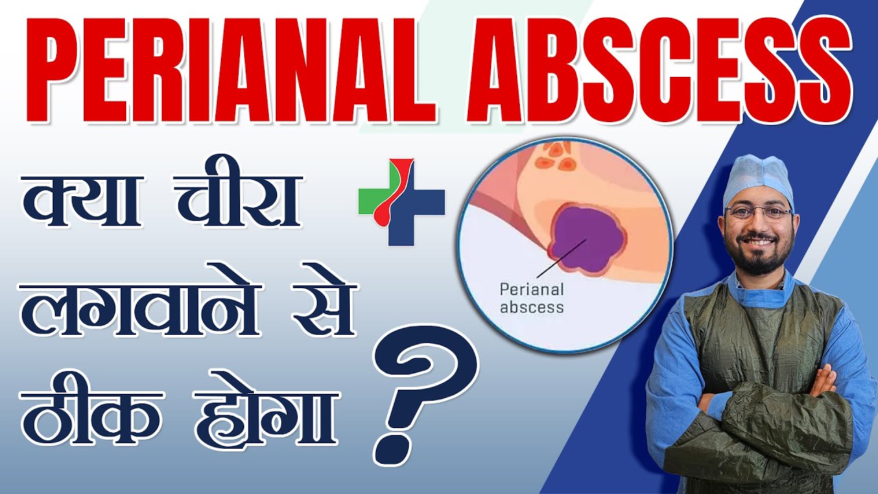 Will Perianal Abscess be cured by incision? Dr. Anshul Shah #PerianalAbscess #fistulatreatment