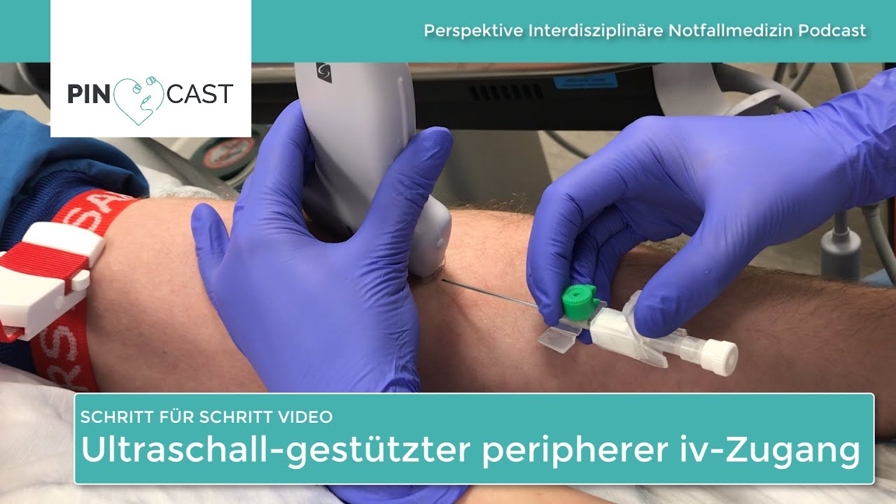 Ultraschall-gest&uuml;tzter peripherer iv-Zugang &ndash; Schritt f&uuml;r Schritt
