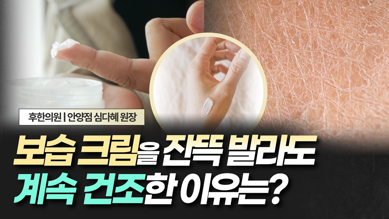 보습크림을 계속 발라도 건조하다면
