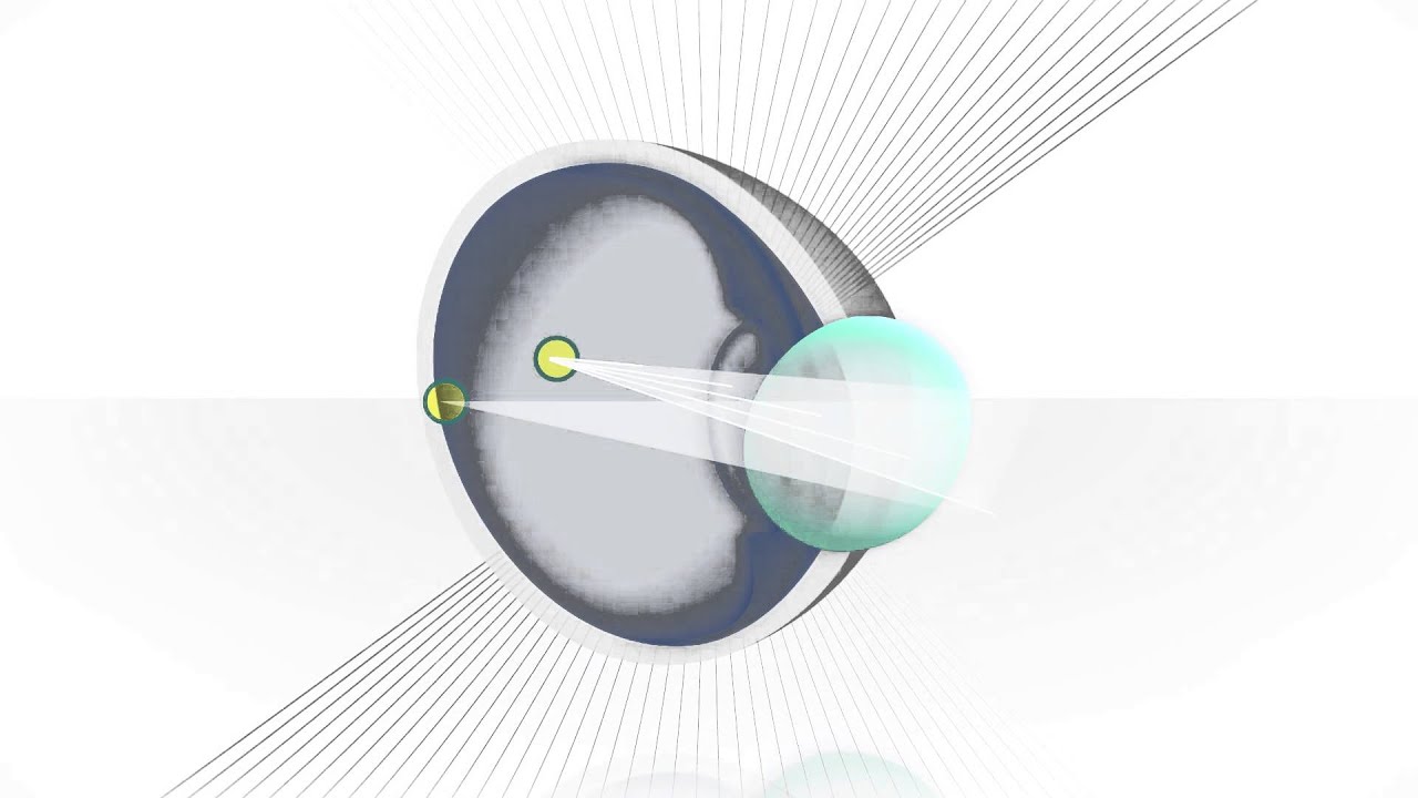 What is Astigmatism? AIR OPTIX&reg; for Astigmatism Contacts Can Help