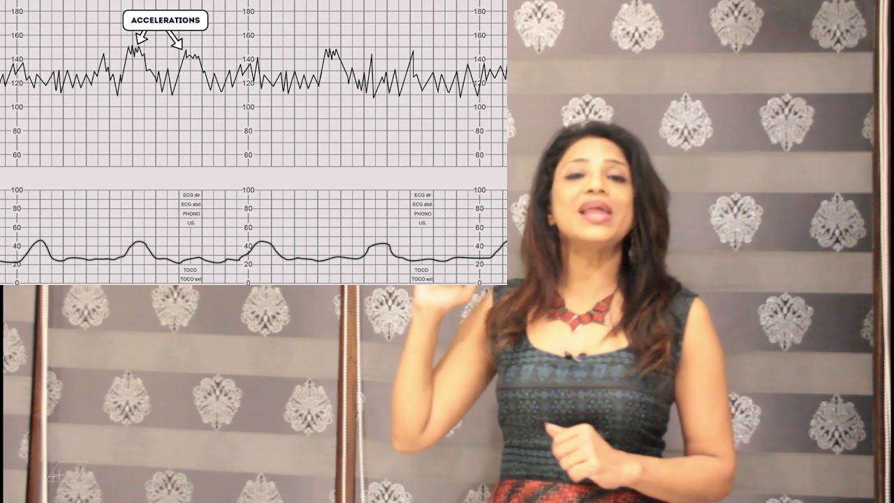 CTG cardiotocography what is CTG why is it done , how does it affect the baby